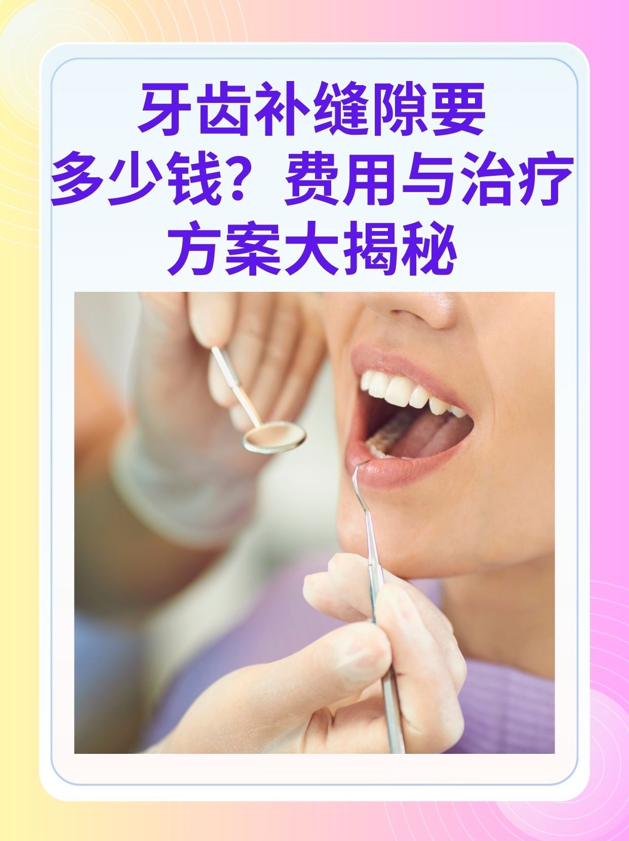 盘锦补牙医保可以报销吗(补牙医保可以报销吗 哪些可以报销呢)